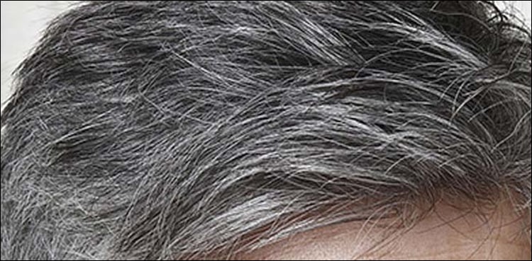 Causes of hair turning white at a young age revealed