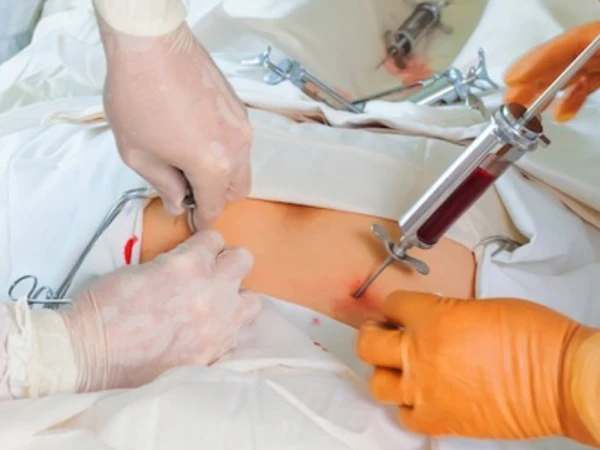 When is a stem cell transplant necessary