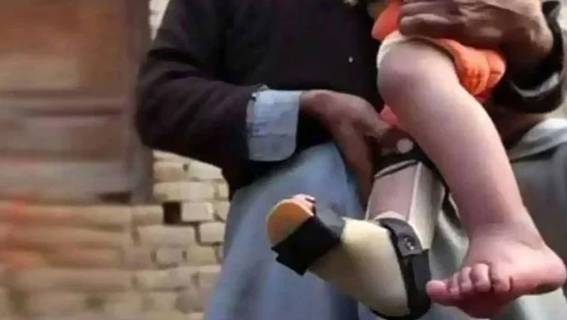 2 new polio cases reported in Khyber Pakhtunkhwa