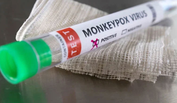 A case of monkeypox has been reported in the country