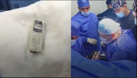 A man in Egypt swallowed a mobile phone