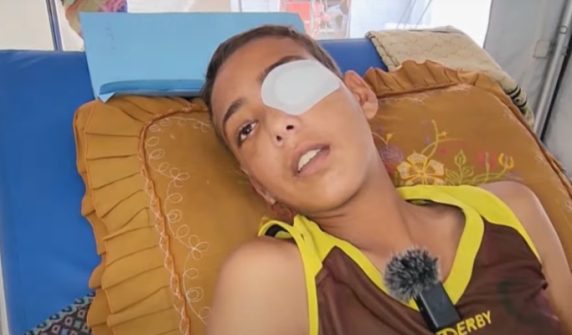 Israeli forces shoot Palestinian boy in the eye while searching for food