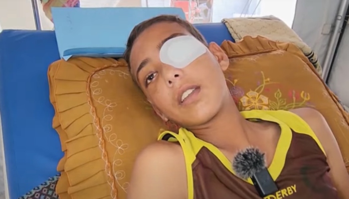 Israeli forces shoot Palestinian boy in the eye while searching for food