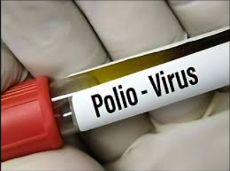 Second confirmed polio case in Punjab this year,