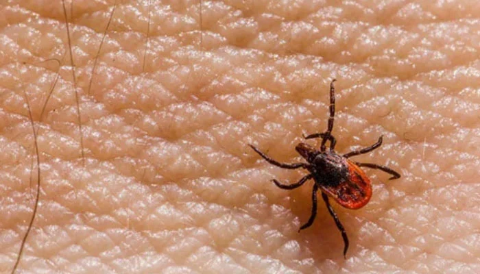 Fifth death from Congo virus confirmed in Sindh this year