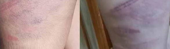 Private school teacher brutally tortures student