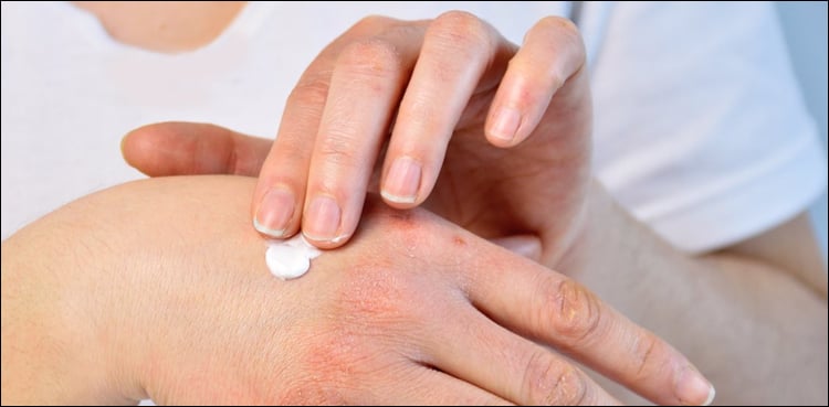 Why does skin become dry, hard, and rough in winter