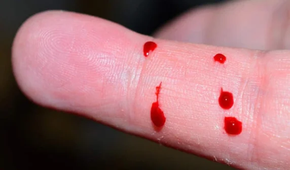 Young man who drank his own blood admitted to hospital