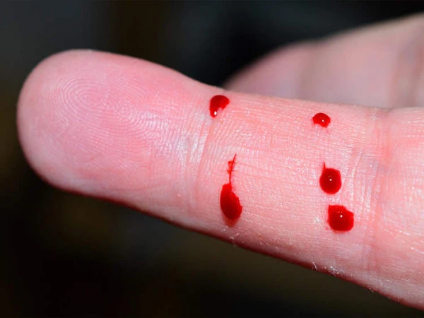 Young man who drank his own blood admitted to hospital