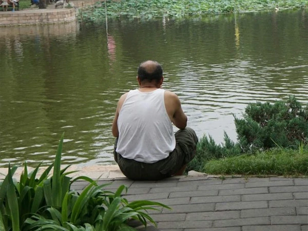 Husband turns out to be bald after being tricked into believing he has thick hair