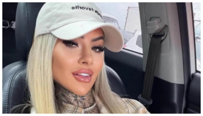 Brazilian influencer dies suddenly 18 days after cosmetic surgery