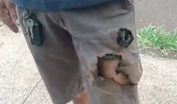 Mobile phone saves citizen from dog attack