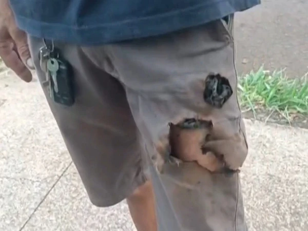 Mobile phone saves citizen from dog attack