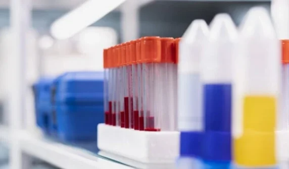 Scientists develop new test technology for TB