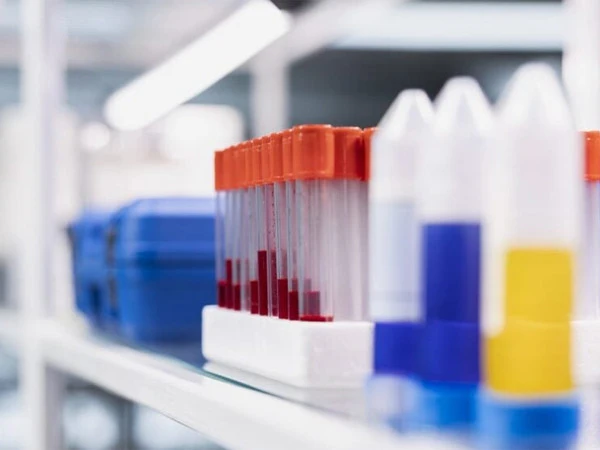 Scientists develop new test technology for TB