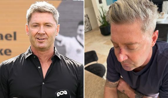 Another skin cancer removed from his face