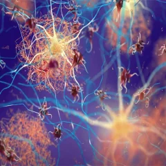 Increasing a protein may make the brain stronger in fighting Alzheimer's