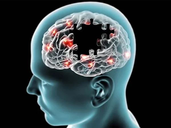 Joint pain medication may cause Alzheimer's to worsen: Research