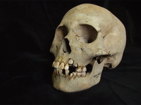 New research on the history of the plague reveals 5,500-year-old evidence