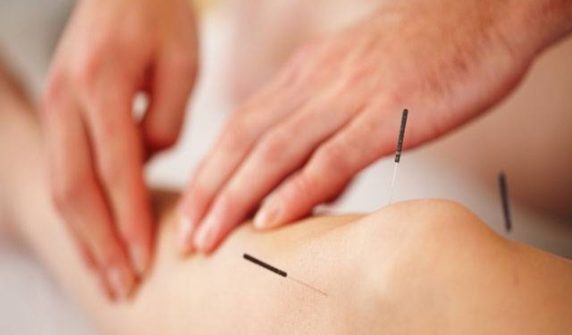 Acupuncture treatment proves costly