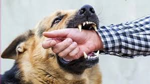 6 people, including 4 children, injured in dog bite incidents