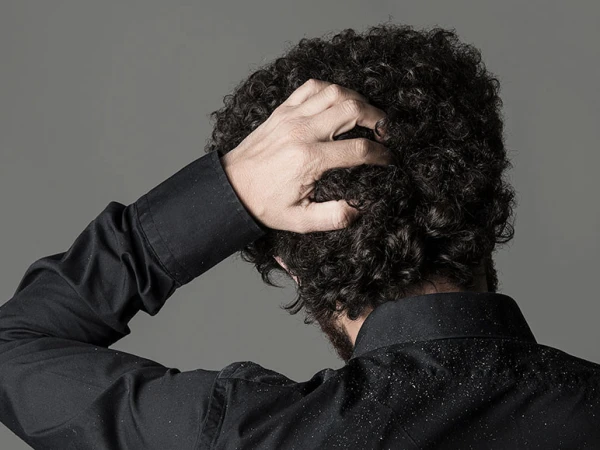Why does the scalp itch repeatedly?