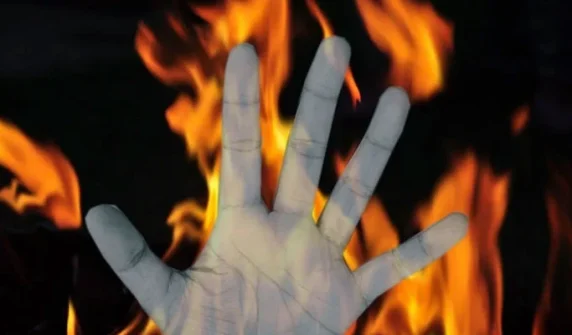 Property dispute—10-year-old boy set on fire after being doused with petrol.