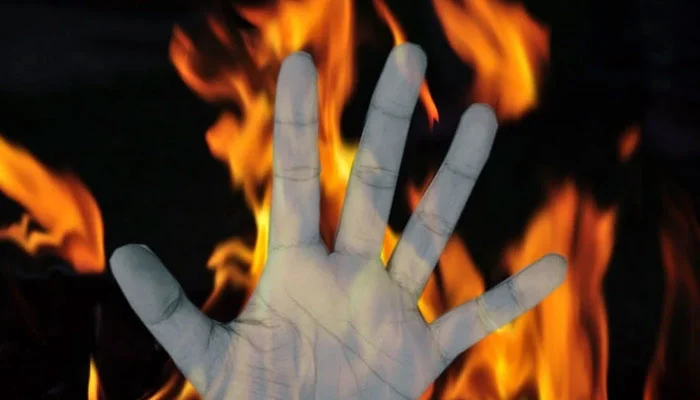 Property dispute—10-year-old boy set on fire after being doused with petrol.