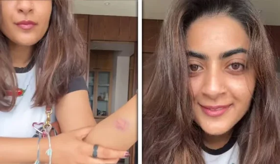 showed injury marks on her body following her arrest