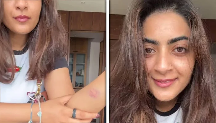 showed injury marks on her body following her arrest